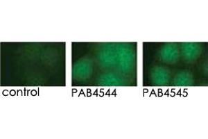 Indirect immunofluorescence analysis of GFP-PRKD3 fusion protein expression in Panc-1 cells by using PRKD3 polyclonal antibody  and PRKD3 polyclonal antibody  . (PRKD3 anticorps  (C-Term))
