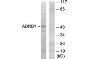 Western Blotting (WB) image for anti-Adrenergic, beta-1-, Receptor (ADRB1) (AA 281-330) antibody (ABIN2889856) (ADRB1 anticorps  (AA 281-330))