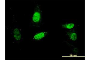 Immunofluorescence of monoclonal antibody to SURB7 on HepG2 cell. (MED21 anticorps  (AA 1-144))