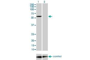 Western blot analysis of YES1 over-expressed 293 cell line, cotransfected with YES1 Validated Chimera RNAi (Lane 2) or non-transfected control (Lane 1). (YES1 anticorps  (AA 1-543))