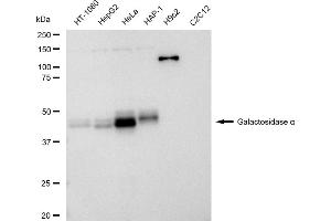 Western blotting analysis using Galactosidase alpha antibody (ABIN7798683).