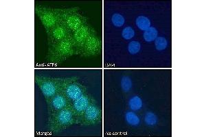 ABIN1590087 Immunofluorescence analysis of paraformaldehyde fixed A431 cells, permeabilized with 0.