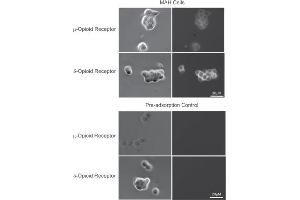 anti-Opioid Receptor, mu 1 (OPRM1) (AA 22-38), (Extracellular), (N-Term) antibody