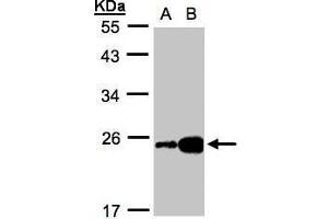 WB Image Sample(30 ug whole cell lysate) A:HeLa S3, B:Hep G2 , 12% SDS PAGE antibody diluted at 1:1000 (FABP6 anticorps)