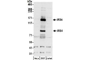 anti-Insulin Receptor Substrate 4 (IRS4) (AA 1207-1257) antibody