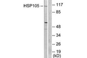 Western blot analysis of extracts from HeLa cells, using HSP105 Antibody. (HSPH1 anticorps  (AA 791-840))