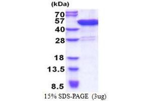 SDS-PAGE (SDS) image for Coiled-Coil Domain Containing 104 (CCDC104) (AA 1-342) protein (His tag) (ABIN5853291)