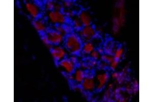 Expression of HCN3 in rat dorsal root ganglia (DRG) - Immunohistochemical staining of frozen section of rat DRG using Anti-HCN3 Antibody (ABIN7043281, ABIN7044972 and ABIN7044973), (1:50) followed by mouse anti-rabbit Alexa Fluor 555 (red).