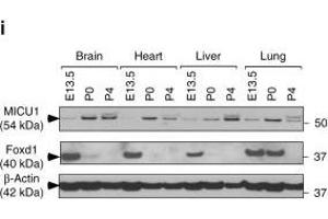 MICU1 is transcriptionally regulated by Foxd1 under hypoxia. (FOXD1 anticorps  (C-Term))