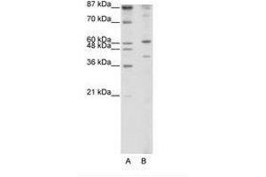 Image no. 1 for anti-REX4, RNA Exonuclease 4 Homolog (REXO4) (N-Term) antibody (ABIN202487) (REXO4 anticorps  (N-Term))