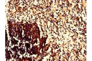 Immunohistochemistry of paraffin-embedded human spleen tissue using ABIN7145141 at dilution of 1:100 (CD79a anticorps  (AA 70-142))