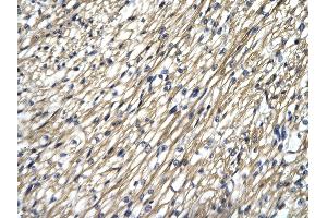 Rabbit Anti-STAT4 antibody Catalog Number: ARP33376  Paraffin Embedded Tissue: Human Heart cell Cellular Data: cardiac cell of renal tubule Antibody Concentration: 4. (STAT4 anticorps  (N-Term))
