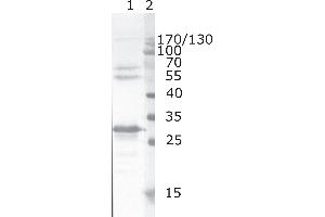 Western Blot testing of HIV-1 recombinant Nef protein. (HIV-1 Nef (AA 62-68) anticorps)