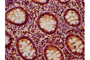 IHC image of ABIN7174121 diluted at 1:400 and staining in paraffin-embedded human appendix tissue performed on a Leica BondTM system.