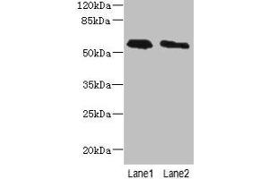 Western blot All lanes: PLD4 antibody at 4 μg/mL Lane 1: THP-1 whole cell lysate Lane 2: Human placenta tissue Secondary Goat polyclonal to rabbit IgG at 1/10000 dilution Predicted band size: 56 kDa Observed band size: 56 kDa (Phospholipase D4 anticorps  (AA 52-506))