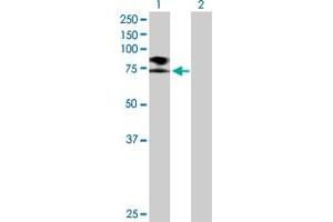 Western Blot analysis of SCNN1B expression in transfected 293T cell line by SCNN1B MaxPab polyclonal antibody.
