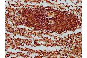 IHC image of ABIN7169487 diluted at 1:400 and staining in paraffin-embedded human spleen tissue performed on a Leica BondTM system. (SH3BP1 anticorps  (AA 161-266))