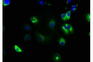 Immunofluorescence staining of MCF-7 cells with ABIN7161298 at 1:133, counter-stained with DAPI.
