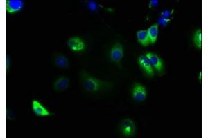 Immunofluorescence staining of MCF-7 cells with ABIN7161298 at 1:133, counter-stained with DAPI. (NOTCH2 anticorps  (AA 59-250))