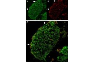 Expression of TRPV2 in mouse DRG - Immunohistochemical staining of TRPV2 in mouse dorsal root ganglion (DRG) using Anti-TRPV2 (VRL1) Antibody (ABIN7043842, ABIN7043990 and ABIN7043991).
