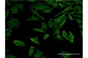 Immunofluorescence of monoclonal antibody to DFNB31 on HeLa cell.