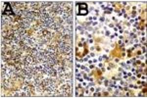 Image no. 1 for anti-Caspase 1 (CASP1) (AA 31-45) antibody (ABIN208361)