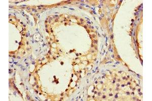 Immunohistochemistry of paraffin-embedded human testis tissue using ABIN7145600 at dilution of 1:100