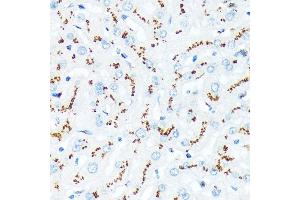 Immunohistochemistry of paraffin-embedded human liver using TGN46/TGOLN2 Rabbit mAb (ABIN7270875) at dilution of 1:100 (40x lens).