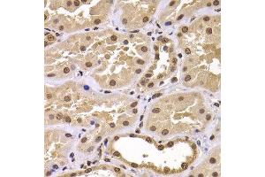 Immunohistochemistry of paraffin-embedded human kidney using CSRP2BP antibody at dilution of 1:100 (x400 lens). (CSRP2BP anticorps)