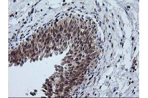 Immunohistochemistry (IHC) image for anti-Formiminotransferase Cyclodeaminase (FTCD) antibody (ABIN1496380)
