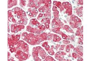 Formalin-fixed and paraffin-embedded H. (PRSS1 anticorps  (AA 81-107))