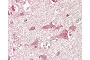 Formalin-fixed and paraffin-embedded H.