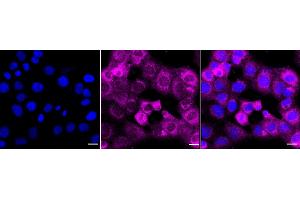 Immunocytochemical staining of HT- cells with NQO1 antibody (ABIN7800954), 1:1,000). (Recombinant NADH Quinone Dehydrogenase 1 anticorps)