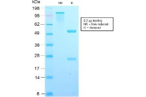 SDS-PAGE Analysis Purified TIMP2 Rabbit Recombinant Monoclonal Antibody (TIMP2/2488R).