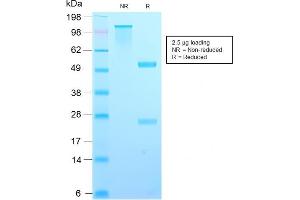SDS-PAGE Analysis Purified TIMP2 Rabbit Recombinant Monoclonal Antibody (TIMP2/2488R). (Recombinant TIMP2 anticorps  (N-Term))