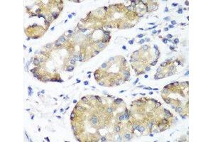 Immunohistochemistry of paraffin-embedded Human stomach using NOTCH2 Polyclonal Antibody at dilution of 1:100 (40x lens). (NOTCH2 anticorps)