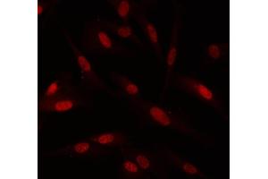 IF analysis of PIN1 using anti-PIN1 antibody (ABIN3042501).