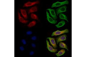 Ferredoxin Reductase Antibody staining Hela cells by IF/ICC. (Ferredoxin Reductase anticorps  (C-Term))