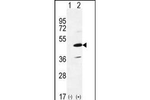 Western blot analysis of IRAK4 (arrow) using rabbit polyclonal IRAK4 Antibody (R20) (ABIN6243238 and ABIN6579012). (IRAK4 anticorps  (N-Term))