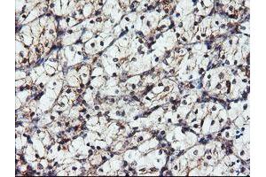 Image no. 3 for anti-Dual Specificity Phosphatase and Pro Isomerase Domain Containing 1 (DUPD1) antibody (ABIN1497927)