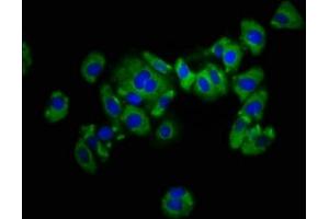 Immunofluorescence staining of HepG2 cells with ABIN7157495 at 1:133, counter-stained with DAPI. (KIR2DL1 anticorps  (AA 162-267))