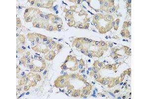 Immunohistochemistry of paraffin-embedded Human stomach using SCG3 Polyclonal Antibody at dilution of 1:100 (40x lens). (SCG3 anticorps)