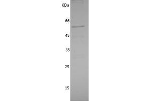 Western Blotting (WB) image for Interleukin-1 Receptor-Associated Kinase 2 (IRAK2) (AA 416-625) protein (GST tag) (ABIN7123627) (IRAK2 Protein (AA 416-625) (GST tag))