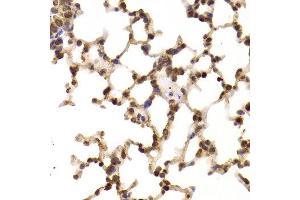Immunohistochemistry of paraffin-embedded Rat lung using EIF5 antibody at dilution of 1:100 (x400 lens). (EIF5 anticorps)