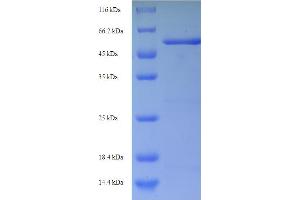 SDS-PAGE (SDS) image for beta-Lactamase (ampC) (AA 27-397) protein (His-SUMO Tag) (ABIN5710844)