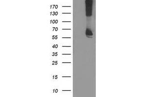 Western Blotting (WB) image for anti-Ribophorin 1 (RPN1) antibody (ABIN1500748)