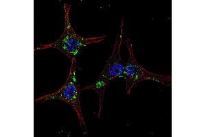 Fluorescent confocal image of HeLa cells stained with SYVN1 (HRD1) (C-term) antibody. (SYVN1 anticorps  (C-Term))