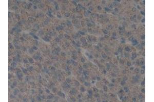 IHC-P analysis of Mouse Ovary Tissue, with DAB staining. (PLAU anticorps  (AA 180-433))