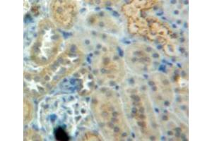 Used in DAB staining on fromalin fixed paraffin-embedded kidney tissue (CSTB anticorps  (AA 2-98))
