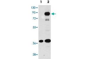 Western blot analysis of PROX1 (arrow) using PROX1 polyclonal antibody . (PROX1 anticorps  (C-Term))